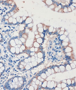 Invitrogen CHDH Polyclonal Antibody 100 &mu;L; Unconjugated:Antibodies,