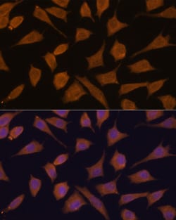 Invitrogen SEPTIN 3 Polyclonal Antibody 100 &mu;L; Unconjugated:Antibodies,
