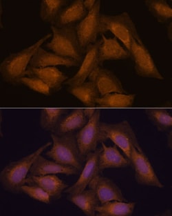 Invitrogen SEPTIN 3 Polyclonal Antibody 100 &mu;L; Unconjugated:Antibodies,