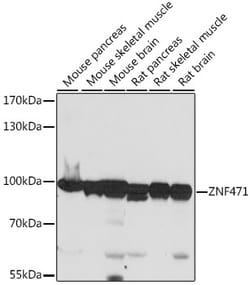 Invitrogen ZNF471 Polyclonal Antibody 100 &mu;L; Unconjugated:Antibodies,