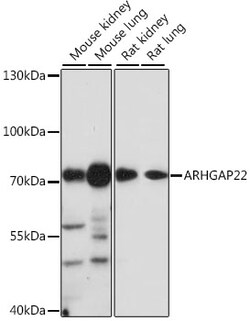 Invitrogen ARHGAP22 Polyclonal Antibody 100 &mu;L; Unconjugated:Antibodies,