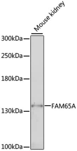 Invitrogen FAM65A Polyclonal Antibody 100 &mu;L; Unconjugated:Antibodies,