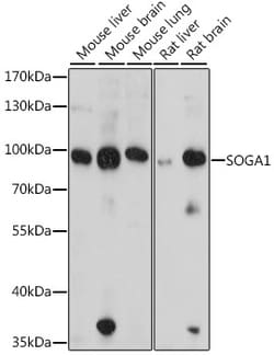 Invitrogen SOGA1 Polyclonal Antibody 100 &mu;L; Unconjugated:Antibodies,