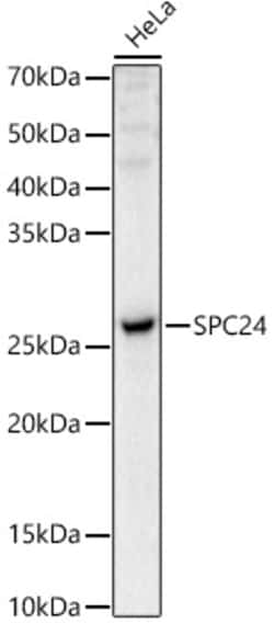 Invitrogen SPC24 Polyclonal Antibody 100 &mu;L; Unconjugated:Antibodies,