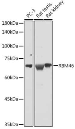 RBM46 Polyclonal Antibody:Antibodies, Polyclonal