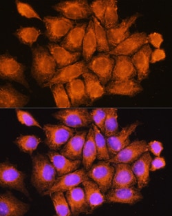 Invitrogen CCDC11 Polyclonal Antibody 100 &mu;L; Unconjugated:Antibodies,