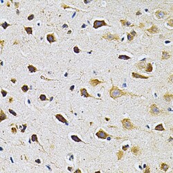 Invitrogen GRK2 Polyclonal Antibody 100 &mu;L; Unconjugated:Antibodies,