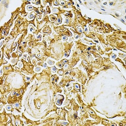 Invitrogen GRK2 Polyclonal Antibody 100 &mu;L; Unconjugated:Antibodies,