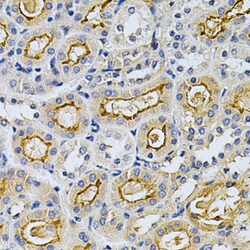 Invitrogen GRK2 Polyclonal Antibody 100 &mu;L; Unconjugated:Antibodies,