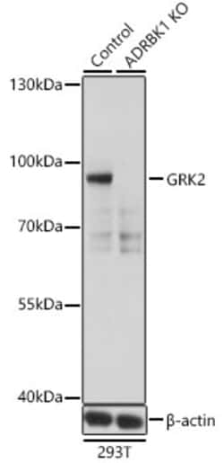 Invitrogen GRK2 Polyclonal Antibody 100 &mu;L; Unconjugated:Antibodies,