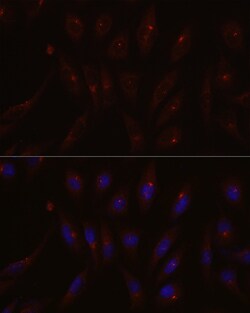 Invitrogen PCM1 Polyclonal Antibody 100 &mu;L; Unconjugated:Antibodies,