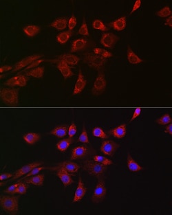 DNM1L Polyclonal Antibody:Antibodies, Polyclonal