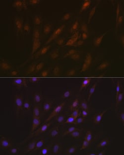 Invitrogen PYCARD Polyclonal Antibody 100 &mu;L; Unconjugated:Antibodies,