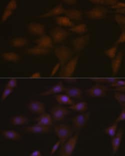 Invitrogen PYCARD Polyclonal Antibody 100 &mu;L; Unconjugated:Antibodies,