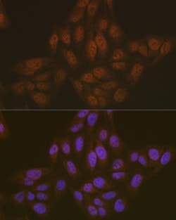 Invitrogen PYCARD Polyclonal Antibody 100 &mu;L; Unconjugated:Antibodies,