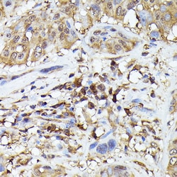 Invitrogen PYCARD Polyclonal Antibody 100 &mu;L; Unconjugated:Antibodies,
