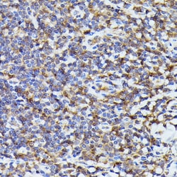 Invitrogen PYCARD Polyclonal Antibody 100 &mu;L; Unconjugated:Antibodies,