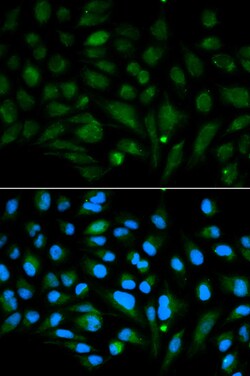 Invitrogen Decorin Polyclonal Antibody 100 &mu;L; Unconjugated:Antibodies,
