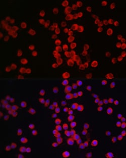 Invitrogen Neuropilin-1 Polyclonal Antibody 100 &mu;L; Unconjugated:Antibodies,