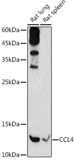 Invitrogen CCL4 Polyclonal Antibody 100 &mu;L | Buy Online | Invitrogen&trade; | Fisher Scientific