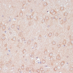 Invitrogen ARL4D Polyclonal Antibody 100 &mu;L; Unconjugated:Antibodies,