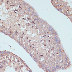 Invitrogen ARL4D Polyclonal Antibody 100 &mu;L; Unconjugated:Antibodies,