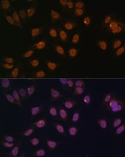 Invitrogen FOXG1 Polyclonal Antibody 100 &mu;L; Unconjugated:Antibodies,