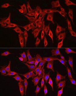 Invitrogen HMGCR Polyclonal Antibody 100 &mu;L | Buy Online | Invitrogen&trade; | Fisher Scientific