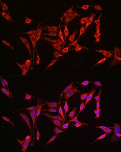 Invitrogen HMGCR Polyclonal Antibody 100 &mu;L | Buy Online | Invitrogen&trade; | Fisher Scientific
