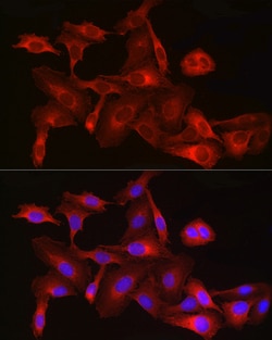 Invitrogen HMGCR Polyclonal Antibody 100 &mu;L | Buy Online | Invitrogen&trade; | Fisher Scientific