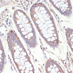 Invitrogen HMGCR Polyclonal Antibody 100 &mu;L | Buy Online | Invitrogen&trade; | Fisher Scientific