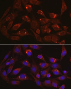 Invitrogen LAMP1 Polyclonal Antibody 100 &mu;L; Unconjugated:Antibodies,