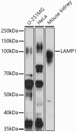Invitrogen LAMP1 Polyclonal Antibody 100 &mu;L; Unconjugated:Antibodies,