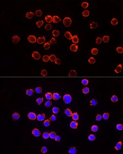 Invitrogen TSG101 Polyclonal Antibody 100 &mu;L; Unconjugated:Antibodies,