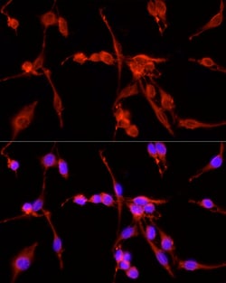 Invitrogen TSG101 Polyclonal Antibody 100 &mu;L; Unconjugated:Antibodies,
