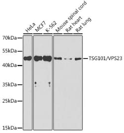 Invitrogen TSG101 Polyclonal Antibody 100 &mu;L; Unconjugated:Antibodies,