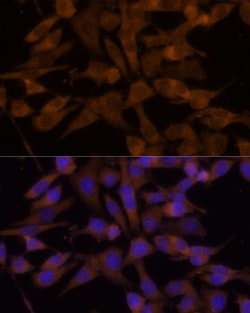 Invitrogen UGT2B7 Polyclonal Antibody 100 &mu;L; Unconjugated:Antibodies,
