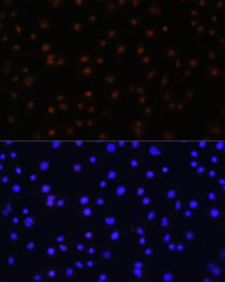 Invitrogen NPAS2 Polyclonal Antibody 100 &mu;L; Unconjugated:Antibodies,