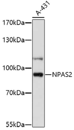 Invitrogen NPAS2 Polyclonal Antibody 100 &mu;L; Unconjugated:Antibodies,