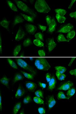 Invitrogen KIR2DL3 Polyclonal Antibody 100 &mu;L; Unconjugated:Antibodies,