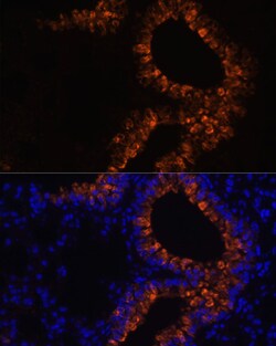 Invitrogen Uteroglobin Polyclonal Antibody 100 &mu;L; Unconjugated:Antibodies,