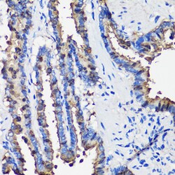 Invitrogen Uteroglobin Polyclonal Antibody 100 &mu;L; Unconjugated:Antibodies,