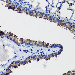 Invitrogen Uteroglobin Polyclonal Antibody 100 &mu;L; Unconjugated:Antibodies,