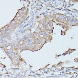 Invitrogen CEACAM1 Polyclonal Antibody 100 &mu;L; Unconjugated:Antibodies,
