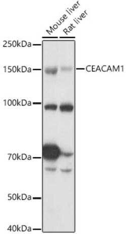 Invitrogen CEACAM1 Polyclonal Antibody 100 &mu;L; Unconjugated:Antibodies,