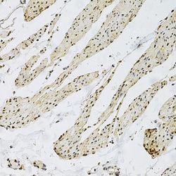 Invitrogen CD9 Polyclonal Antibody 100 &mu;L; Unconjugated:Antibodies,