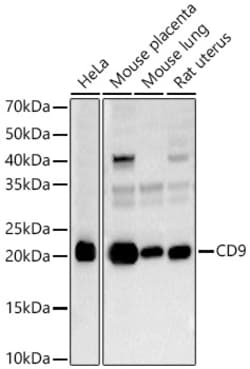 Invitrogen CD9 Polyclonal Antibody 100 &mu;L; Unconjugated:Antibodies,