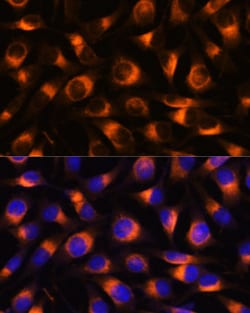 Invitrogen VAT1 Polyclonal Antibody 100 &mu;L; Unconjugated:Antibodies,