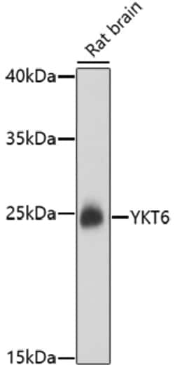 Invitrogen YKT6 Polyclonal Antibody 100 &mu;L | Buy Online | Invitrogen&trade; | Fisher Scientific