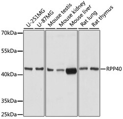 Invitrogen RPP40 Polyclonal Antibody 100 &mu;L; Unconjugated:Antibodies,